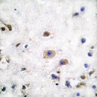 19 - Anti-Ephrin B3 Antibody AP51181