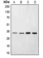 1 - Anti-Ephrin B3 Antibody AP51181