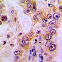 19 - Anti-EHHADH Antibody AP51182