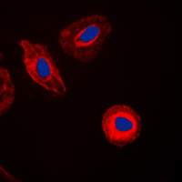 3 - Anti-EIF4G2 Antibody AP51184