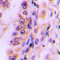 19 - Anti-EIF4G2 Antibody AP51184