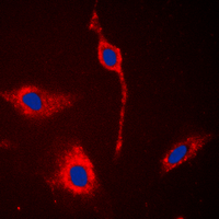 3 - Anti-EPHA6 Antibody AP51189