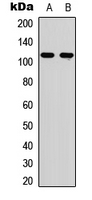 1 - Anti-EPHA6 Antibody AP51189