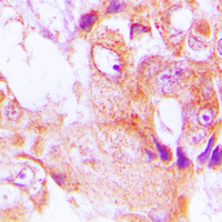 19 - Anti-ABHD9 Antibody AP51190