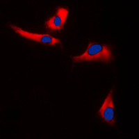 3 - Anti-EPS8L3 Antibody AP51191