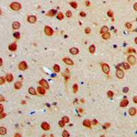 19 - Anti-ERAP1 Antibody AP51192