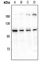 1 - Anti-ERAP1 Antibody AP51192