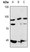 1 - Anti-ERCC4 Antibody AP51195