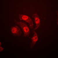 3 - Anti-ETS1 (Phospho-T38) Antibody AP51196