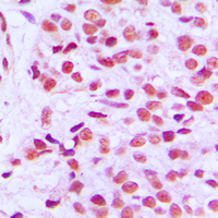 19 - Anti-ETS1 (Phospho-T38) Antibody AP51196