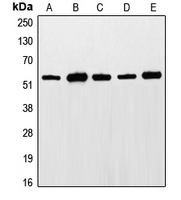 1 - Anti-ETS1 (Phospho-T38) Antibody AP51196