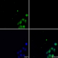 3 - Anti-ETV1 Antibody AP51197