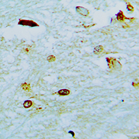 19 - Anti-ETV1 Antibody AP51197