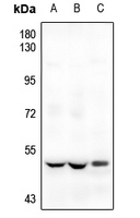 1 - Anti-ETV1 Antibody AP51197