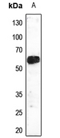 1 - Anti-TEL Antibody AP51198