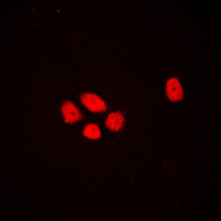 3 - Anti-EXO1 Antibody AP51200