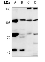 1 - Anti-EXO1 Antibody AP51200