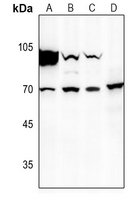 1 - Anti-Factor X HC Antibody AP51201