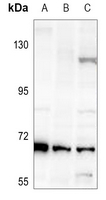 1 - Anti-Factor XII HC Antibody AP51202