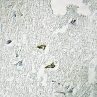 19 - Anti-CD178 Antibody AP51204