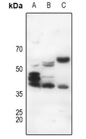 1 - Anti-CD178 Antibody AP51204