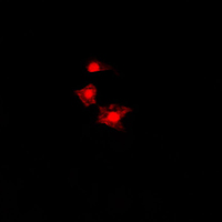 3 - Anti-FAST Kinase Antibody AP51205