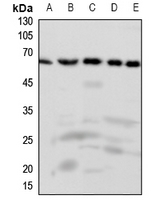 1 - Anti-FAST Kinase Antibody AP51205