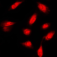 3 - Anti-c-FER Antibody AP51206