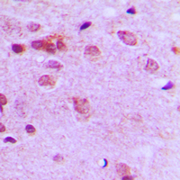 19 - Anti-c-FER Antibody AP51206