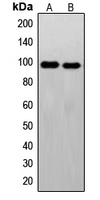 1 - Anti-c-FER Antibody AP51206