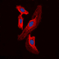 3 - Anti-FHIT Antibody AP51208