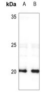 1 - Anti-FHIT Antibody AP51208