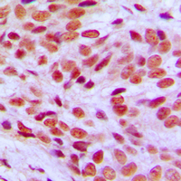 19 - Anti-FLI1 Antibody AP51209