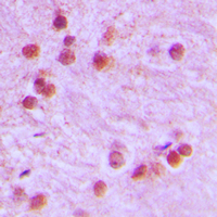 19 - Anti-FOXR1 Antibody AP51211