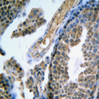 19 - Anti-FSHR Antibody AP51214