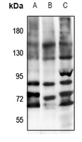1 - Anti-FSHR Antibody AP51214