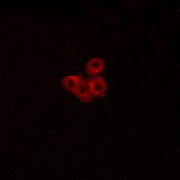 3 - Anti-FSHR Antibody AP51215