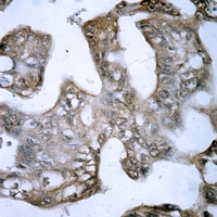 19 - Anti-FSHR Antibody AP51215