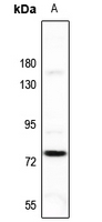 1 - Anti-FSHR Antibody AP51215
