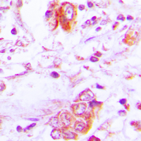 19 - Anti-Follistatin Antibody AP51216