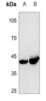 1 - Anti-Follistatin Antibody AP51216