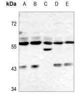 1 - Anti-FTO Antibody AP51217