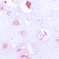 19 - Anti-FXR2 Antibody AP51218