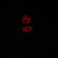 3 - Anti-Frizzled 5 Antibody AP51219