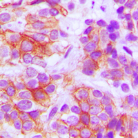 19 - Anti-Frizzled 5 Antibody AP51219
