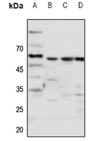 1 - Anti-Frizzled 5 Antibody AP51219
