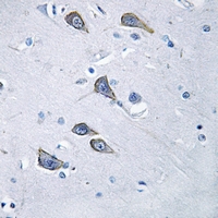 19 - Anti-Frizzled 6 Antibody AP51220