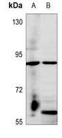 1 - Anti-Frizzled 6 Antibody AP51220
