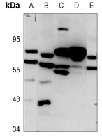 1 - Anti-Frizzled 8 Antibody AP51221