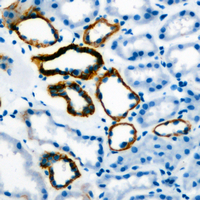 19 - Anti-Gastrin Antibody AP51223